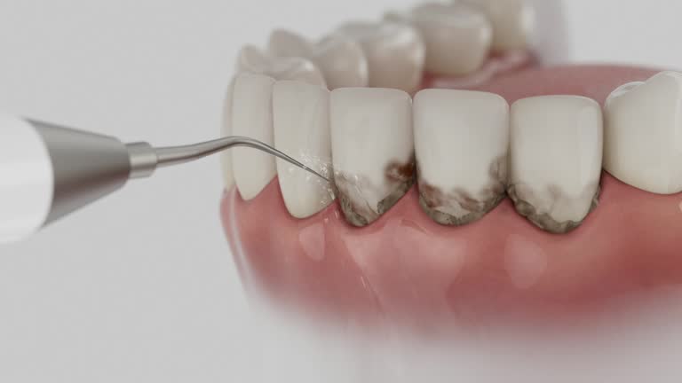 Trusted Teeth Cleaning And Checkup service in Platte, SD - Dentist Open Now